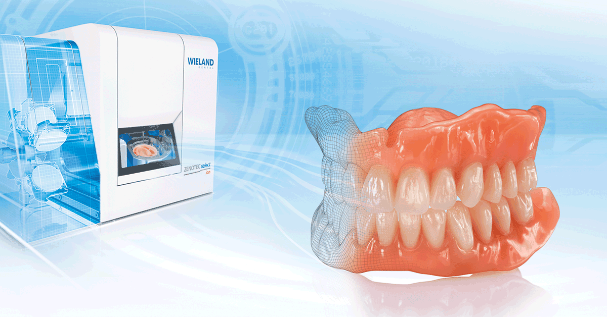 Traditional Dentures vs Digital Dentures